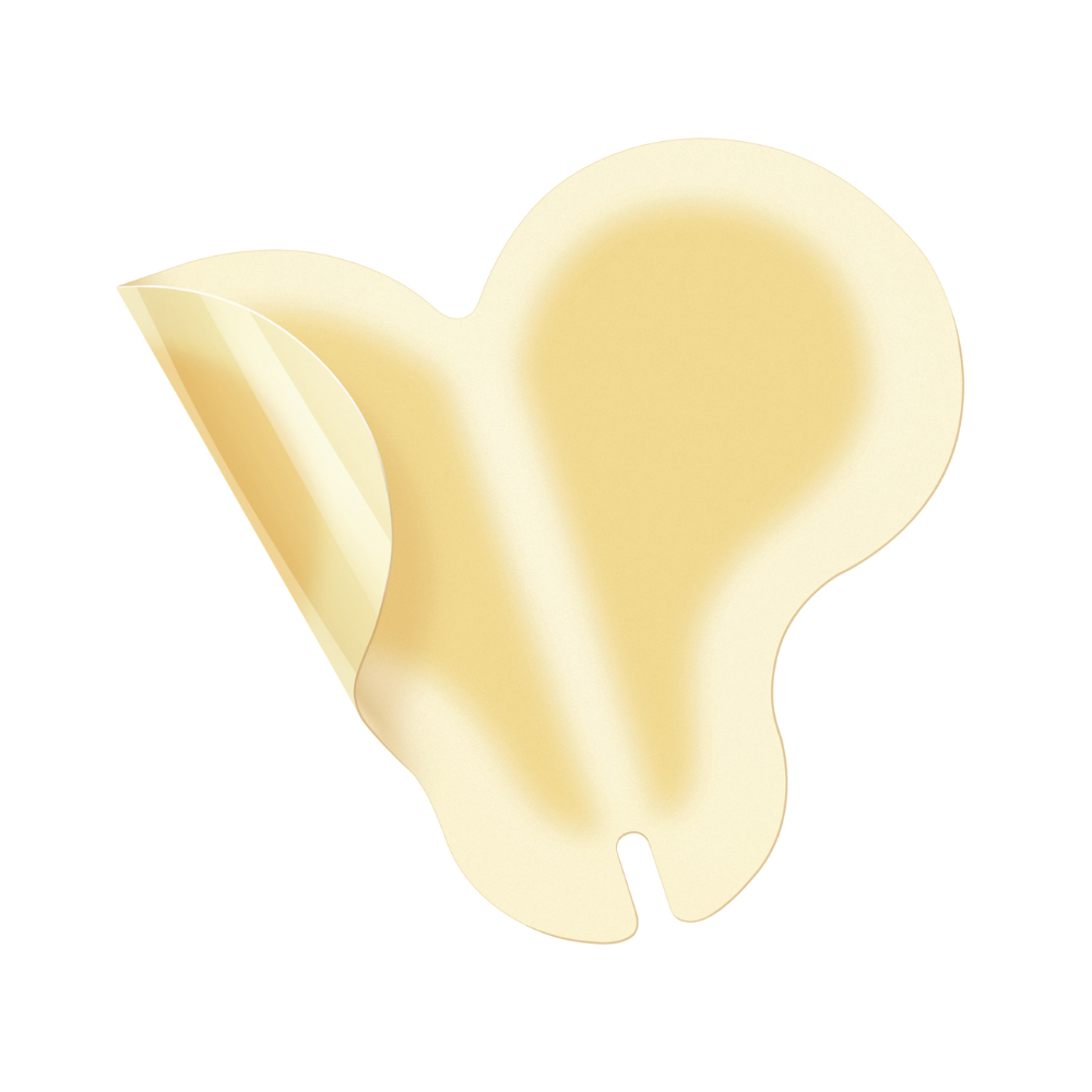 Σε λευκό φόντο φαίνεται ένας μεμονωμένος επίδεσμος Hartmann Hydrocoll Classic Sacral (12 x 18 cm, μπεζ, σε σχήμα πεταλούδας) της Paul Hartmann AG, εν μέρει αφαιρεμένος από το υπόστρωμα για υγρή θεραπεία τραυμάτων. Η συσκευασία περιέχει 5 τεμάχια.